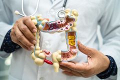 Střevo a mozek tvoří osu. Záněty zažívacího traktu ovlivňují psychiku a naopak