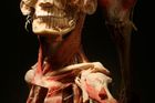 Metodu konzervace lidských těl, pojmenovanou plastinace, vymyslel německý anatom Gunther von Hagens. Vodu a tuk při ní nahrazuje plastická hmota.