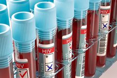 Výpadek amerických peněz by mohl způsobit smrt milionů lidí. Ohrožen je boj proti HIV